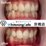 半額キャンペーン!! 本来の白さを手に入れよう。 【Whitening Cafe】